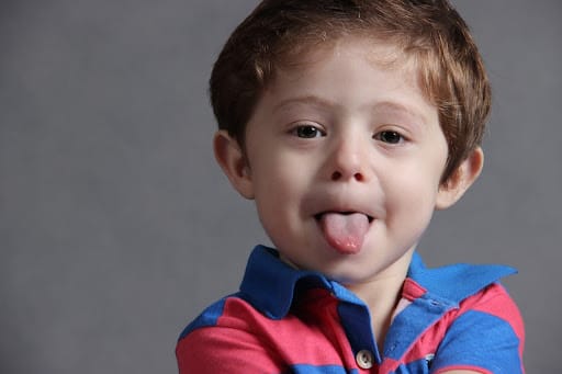 What are the Symptoms of Orofacial Myofunctional Disorders?